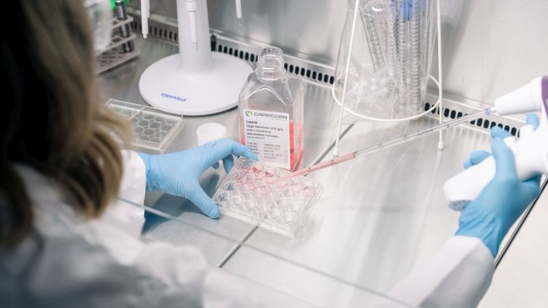 Modellstudie zum Antiepileptikum Valproat: Einfluss auf frühe Hirnentwicklung 