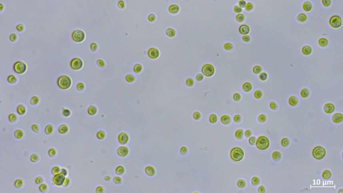 Die Alge Chlorella vulgaris unter dem Lichtmikroskop