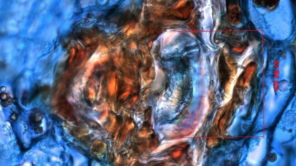 Forschende des KIT wollen Konflikt zwischen Wirkstoffgewinnung und Artenschutz lösen