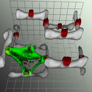 Die Aufnahme der Zelle im Zweikomponenten-Polymerger&uuml;st entstand mithilfe eines Laser-Scanning-Mikroskops (LSM). Gr&uuml;n gef&auml;rbt ist das Zytoskelett der Zelle, wei&szlig; wiedergegeben werden Teile des Zweikomponenten-Polymerger&uuml;stes, die "Zellgriffe" sind rot koloriert. (Bild: CFN)