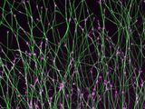 Embryonale Hirnentwicklung in der Petrischale: Axone (gruen) der Nervenzellen der Netzhaut lesen beim Wachstum mittels eines mit molekularen Antennen ausgestatteten Wachstumskegels (magenta) an ihrem Ende biochemische Signale, die sie an ihr Ziel bringen,