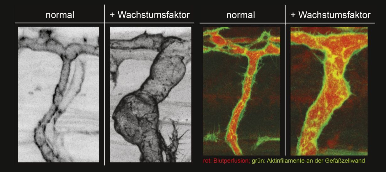 (Abb.: ZOO, KIT Darstellung natürlich wachsender lebender Arterien und fluoreszenzmikroskopische Darstellung des Blutflusses und des endothelialen Aktin Zytoskeletts. Ausführliche Bildbeschreibung am Textende. (Abb.: ZOO, KIT)